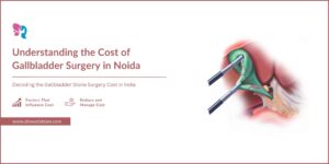 Read more about the article Cost of Gallbladder Surgery in Noida, India – Dr Swati