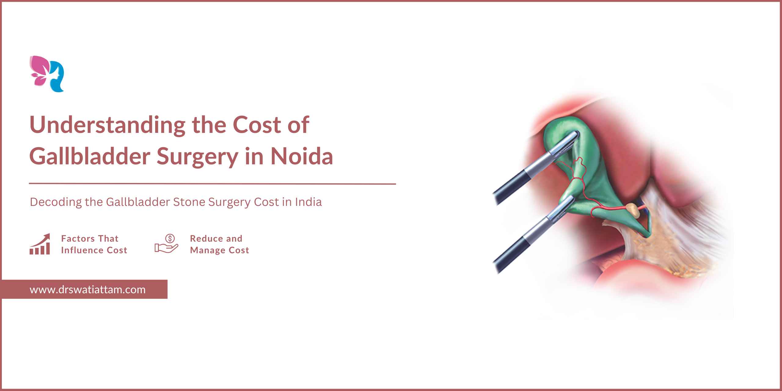 Feature image for Gladder surgery cost blog