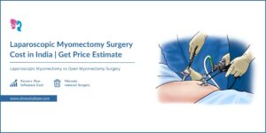 Read more about the article Fibroid Removal Surgery Cost | Myomectomy Surgery Cost in Noida, India